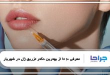 بهترین دکتر تزریق ژل در شهریار