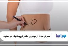 بهترین دکتر لیپوماتیک در مشهد