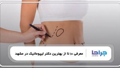 بهترین دکتر لیپوماتیک در مشهد