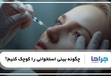 چگونه بینی استخوانی را کوچک کنیم؟