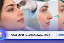 چگونه بینی استخوانی را کوچک کنیم؟
