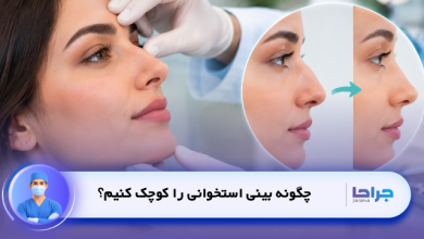 چگونه بینی استخوانی را کوچک کنیم؟