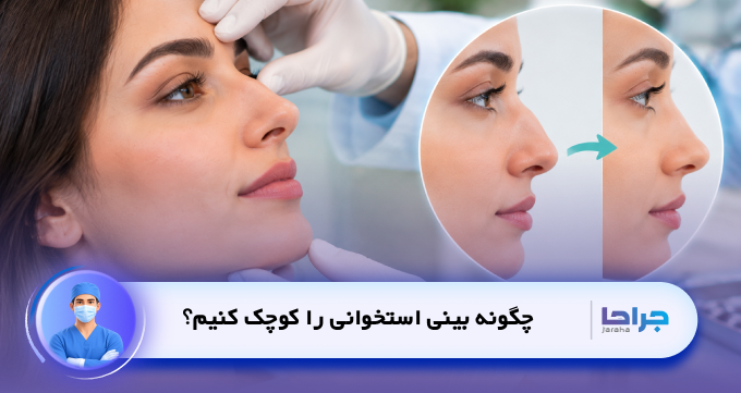 چگونه بینی استخوانی را کوچک کنیم؟