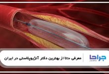 10 تا از بهترین دکتر آنژیوپلاستی در ایران❤️【سال1405】⭐