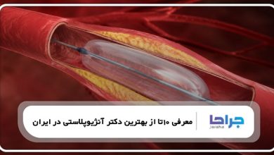 10 تا از بهترین دکتر آنژیوپلاستی در ایران❤️【سال1405】⭐