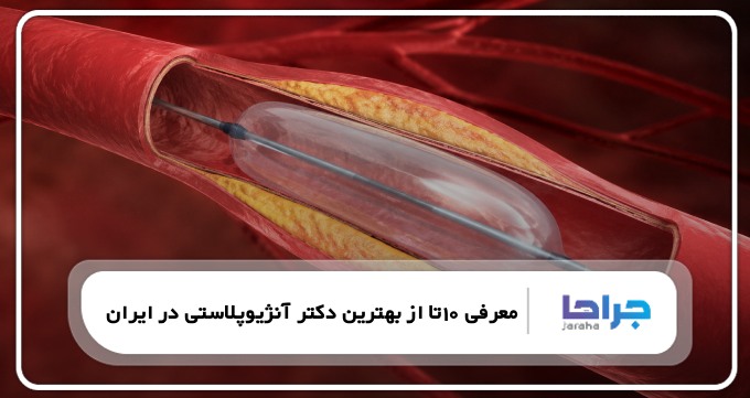10 تا از بهترین دکتر آنژیوپلاستی در ایران❤️【سال1405】⭐