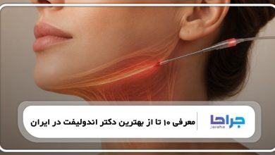 https://jaraha.com/the-best-endolift-doctor-in-iran/