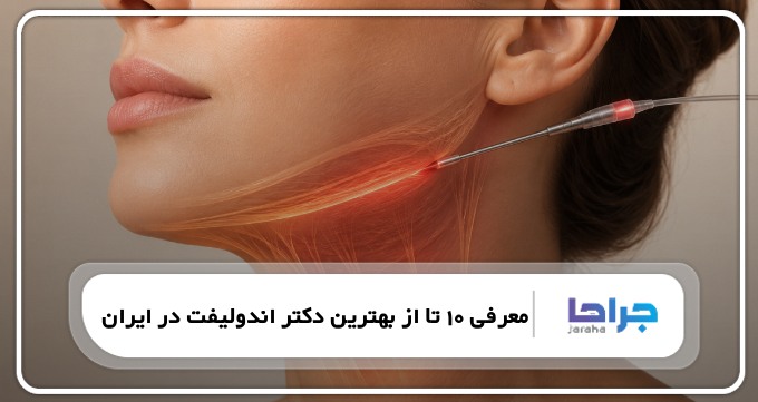 https://jaraha.com/the-best-endolift-doctor-in-iran/