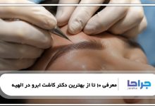 معرفی 10 تا از بهترین دکتر کاشت ابرو در الهیه⭐【سال1405】⚡