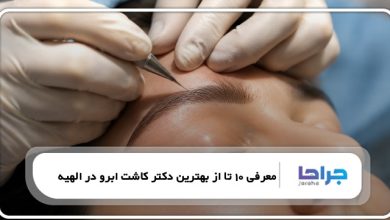 معرفی 10 تا از بهترین دکتر کاشت ابرو در الهیه⭐【سال1405】⚡