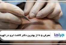 معرفی 5 تا از بهترین دکتر کاشت ابرو در الهیه⭐【سال1405】⚡