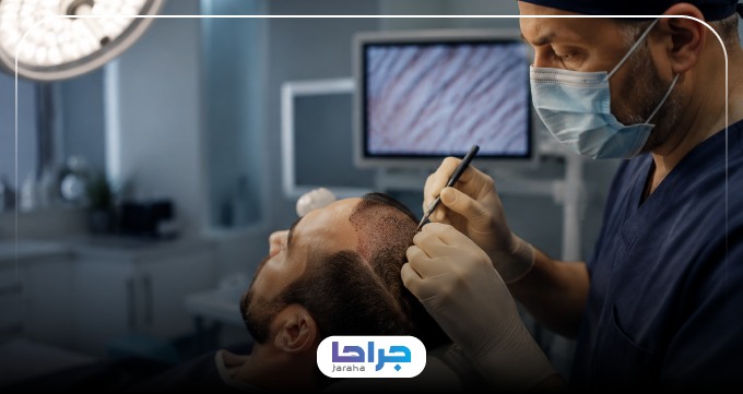 دکتر کاشت مو چه روشهایی را توصیه میکند؟