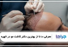 معرفی 10 تا از بهترین دکتر کاشت مو در الهیه⭐【سال1405】⚡