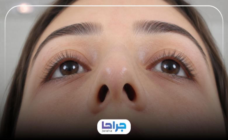 توصیه های لازم جهت جراحی بینی ترمیمی