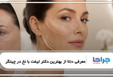 10تا از بهترین دکتر لیفت با نخ در چیتگر❤️【سال1405】⭐