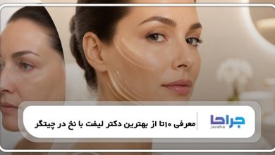 10تا از بهترین دکتر لیفت با نخ در چیتگر❤️【سال1405】⭐