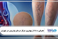 10 تا از بهترین مرکز درمان واریس در تهران ⭐【سال1405】❤️
