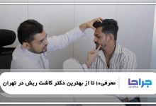 بهترین دکتر کاشت ریش در تهران