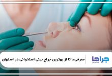 معرفی 10 تا از بهترین جراح بینی استخوانی در اصفهان