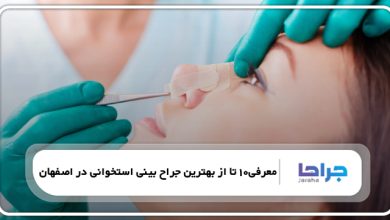 معرفی 10 تا از بهترین جراح بینی استخوانی در اصفهان