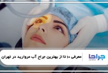 معرفی 10 تا از بهترین جراح آب مروارید در تهران
