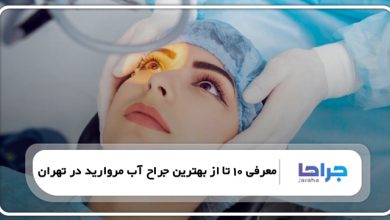معرفی 10 تا از بهترین جراح آب مروارید در تهران