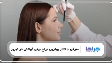 بهترین جراح بینی گوشتی در تبریز