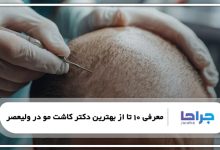 بهترین دکتر کاشت مو در ولیعصر
