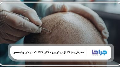 بهترین دکتر کاشت مو در ولیعصر