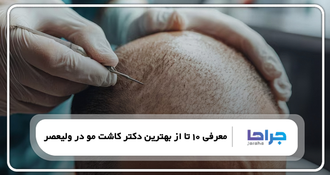بهترین دکتر کاشت مو در ولیعصر