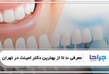 معرفی 10 تا از بهترین دکتر لمینت در تهران