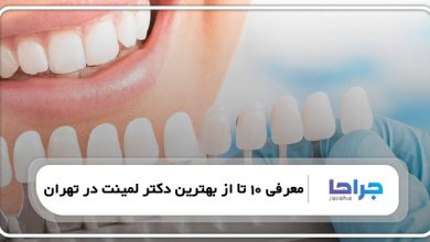 معرفی 10 تا از بهترین دکتر لمینت در تهران