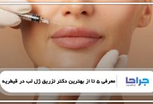 بهترین دکتر تزریق ژل لب در قیطریه