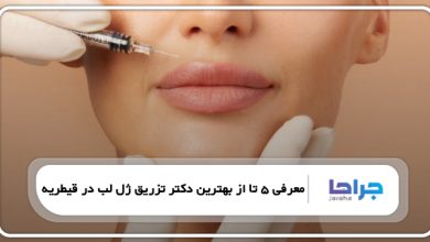 بهترین دکتر تزریق ژل لب در قیطریه