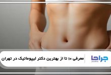 بهترین دکتر لیپوماتیک در تهران