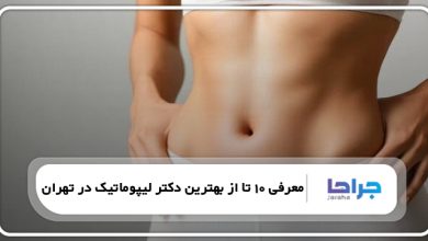 بهترین دکتر لیپوماتیک در تهران