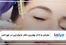 بهترین دکتر مزوتراپی در تهرانسر