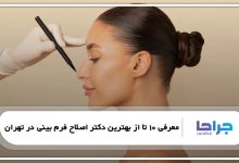 بهترین دکتر اصلاح فرم بینی در تهران