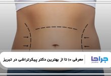 بهترین دکتر پیکرتراشی در تبریز