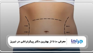 بهترین دکتر پیکرتراشی در تبریز