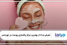 بهترین مرکز پاکسازی پوست در تهرانسر