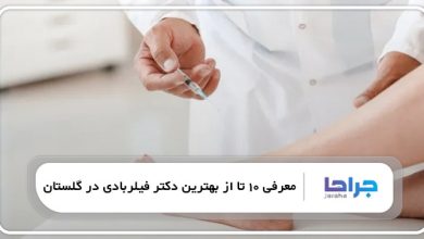 بهترین دکتر فیلربادی در گلستان