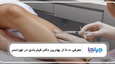 بهترین دکتر فیلربادی در تهرانسر