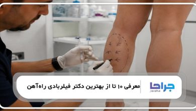 بهترین دکتر فیلربادی در راهآهن