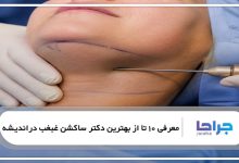 بهترین دکتر ساکشن غبغب در اندیشه