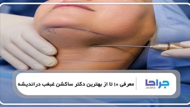 بهترین دکتر ساکشن غبغب در اندیشه