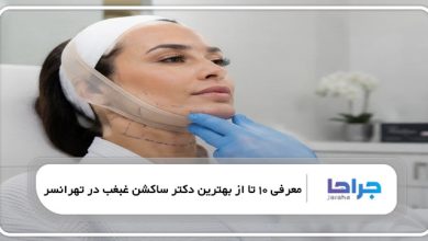 بهترین دکتر ساکشن غبغب در تهرانسر