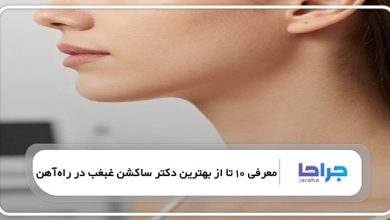 بهترین دکتر ساکشن غبغب در راهآهن