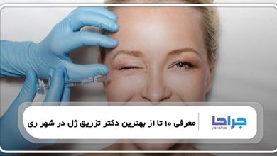 بهترین دکتر تزریق ژل در شهر ری