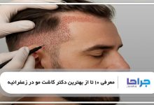 بهترین دکتر کاشت مو در زعفرانیه